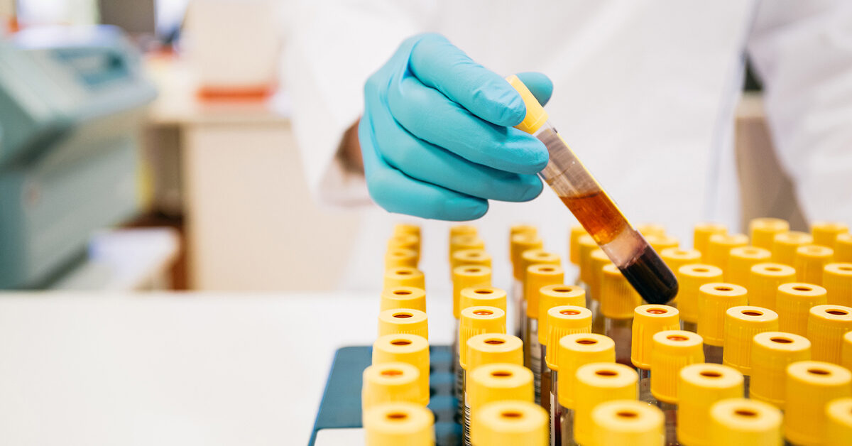 Quais As Siglas dos Exames de Sangue? VIDA Software para Laboratório